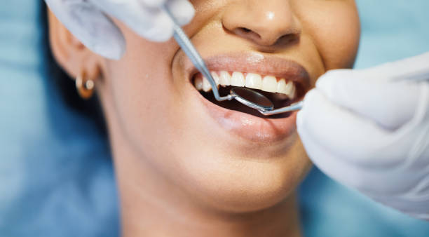 Best Chipped Tooth Repair Near Me  in Hunter, OH